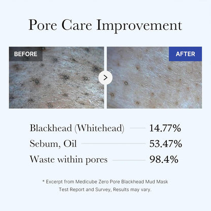 Zero Pore Blackhead Mud Facial Mask - Skin Cooling & Pore Tightening - 3 Minute Quick Dry Formula with AHA, BHA, PHA, and Pore-Purifying Clay - Korean Mud Mask 3.52 oz