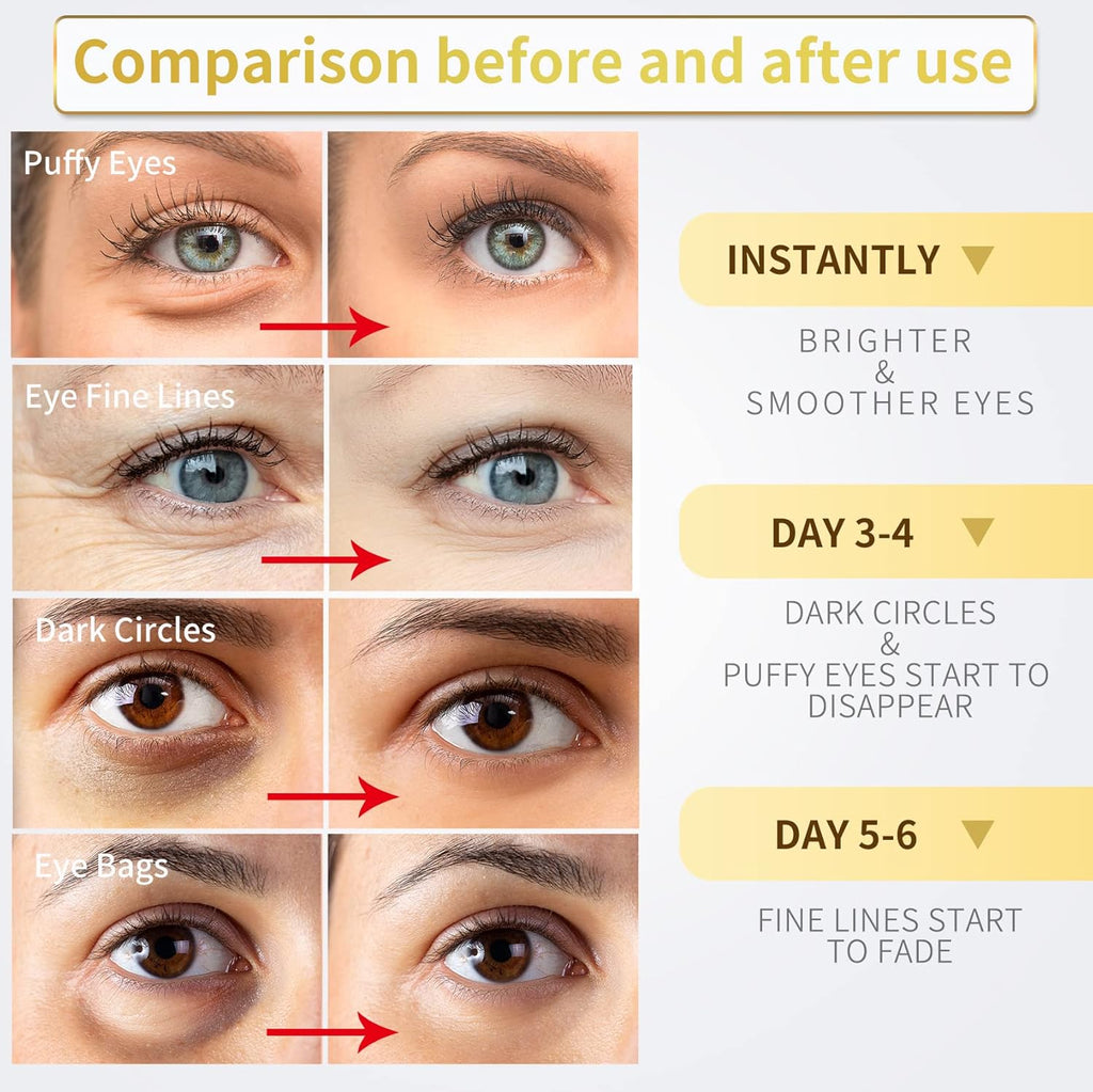 24K Gold Under Eye Patches - 60 Pack for Puffy Eyes, Dark Circles, Bags & Wrinkles with Collagen & Hyaluronic Acid